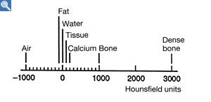 fig16