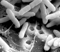 Pseudomonas aeruginosa. СЭМ