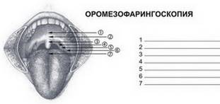Оромезофарингоскопия2